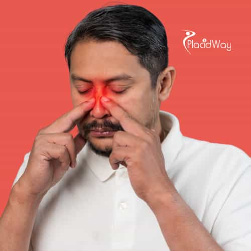 Understanding Holistic Sinus and Nose Cancer Treatment Options in Mexico